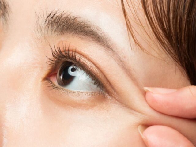 Các biến chứng khi nhấn mí tại cơ sở không uy tín 