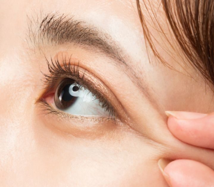 Các biến chứng khi nhấn mí tại cơ sở không uy tín 