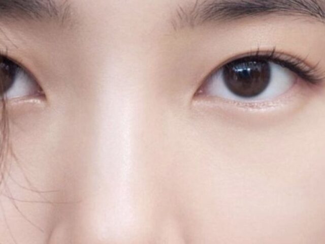 Mí lót có nên nhấn mí hay không