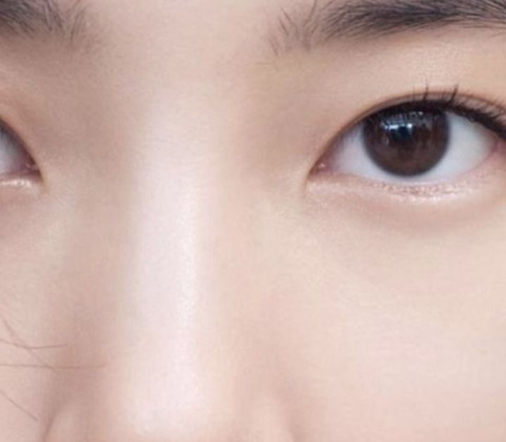 Mí lót có nên nhấn mí hay không