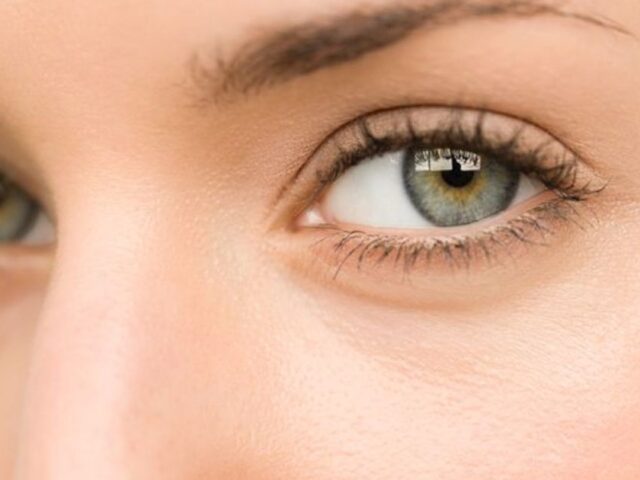 Nhấn mí bị lệch phải làm sao