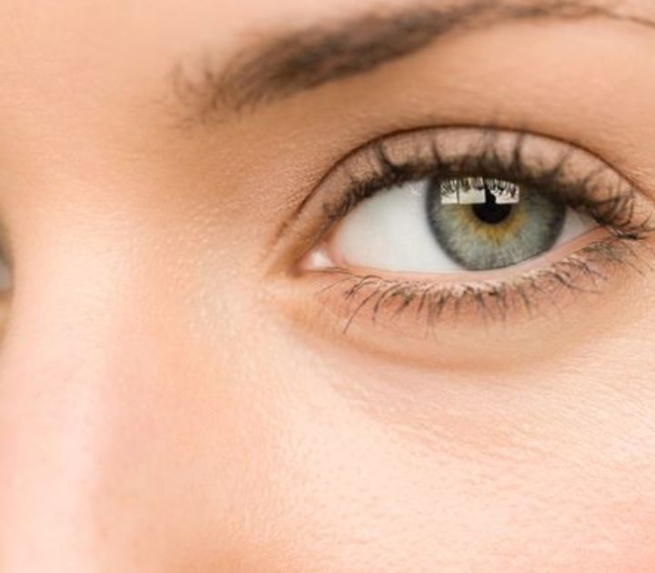 Nhấn mí bị lệch phải làm sao